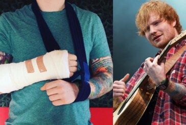 Ed Sheeran Broke His Arm After Being Hit By a Car, Rushed To Hospital in London