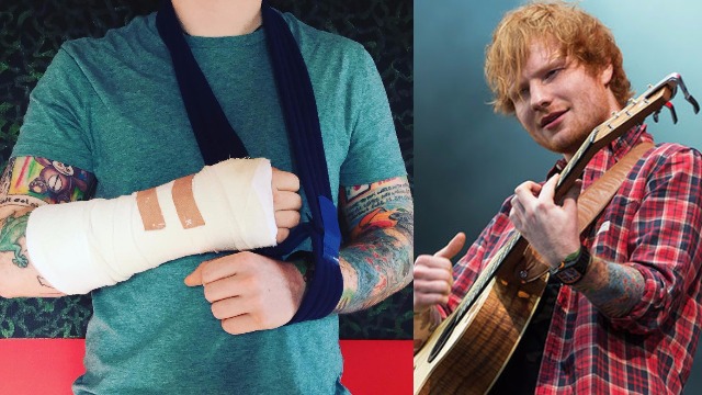 Ed Sheeran Broke His Arm After Being Hit By a Car, Rushed To Hospital in London
